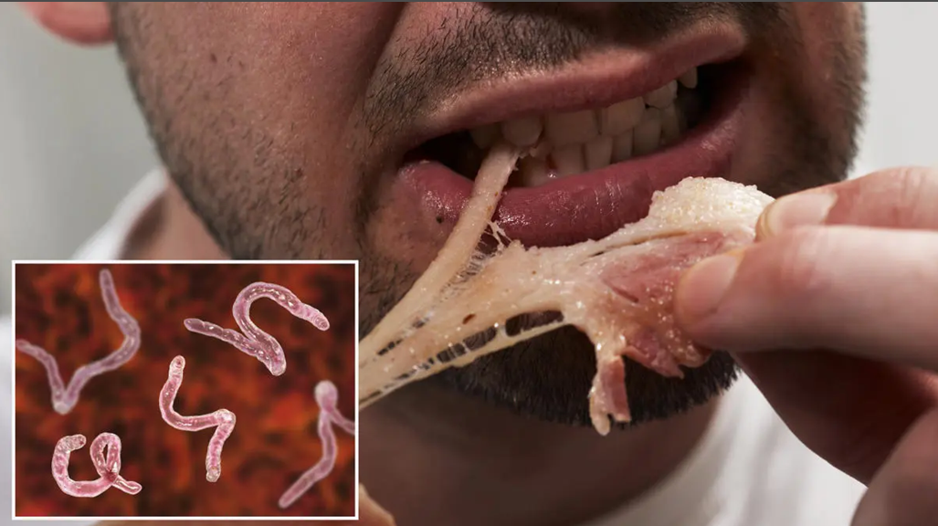 How Do Parasitic worms enter our Food supply?